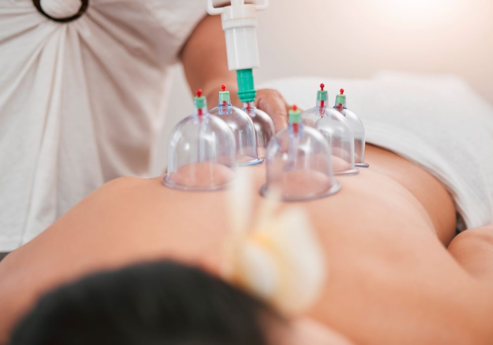 Hijama (Cupping Therapy) : Benefits and Why You Should Try It